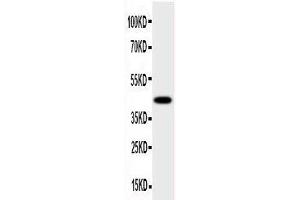 Anti-HSD17B2 antibody, Western blotting All lanes: Anti HSD17B2  at 0. (HSD17B2 Antikörper  (C-Term))