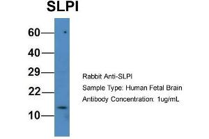 Host: Rabbit  Target Name: SLPI  Sample Tissue: Human Fetal Brain  Antibody Dilution: 1.