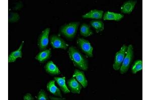 Immunofluorescent analysis of A549 cells using ABIN7168384 at dilution of 1:100 and Alexa Fluor 488-congugated AffiniPure Goat Anti-Rabbit IgG(H+L) (NOB1 Antikörper  (AA 103-229))