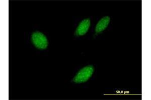 Immunofluorescence of purified MaxPab antibody to TXNL4B on HeLa cell. (TXNL4B Antikörper  (AA 1-149))