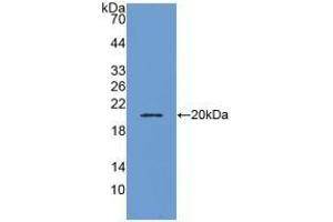 Western blot analysis of recombinant Human ADM. (Adrenomedullin Antikörper  (AA 22-147))