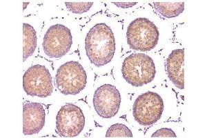 IHC analysis of WWOX using anti-WWOX antibody (ABIN6719627). (WWOX Antikörper  (AA 1-245))