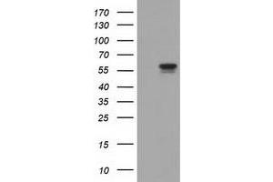 HEK293T cells were transfected with the pCMV6-ENTRY control (Left lane) or pCMV6-ENTRY DYNC1LI1 (Right lane) cDNA for 48 hrs and lysed. (DYNC1LI1 Antikörper)