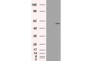 HEK293T cells were transfected with the pCMV6-ENTRY control (Left lane) or pCMV6-ENTRY CYP2E1 (Right lane) cDNA for 48 hrs and lysed. (CYP2E1 Antikörper)