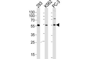 Western Blotting (WB) image for anti-Phosphatidylinositol-4-Phosphate 5-Kinase-Like 1 (PIP5KL1) antibody (ABIN2996126) (PIP5KL1 Antikörper)