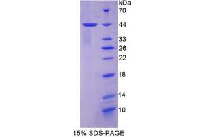 SDS-PAGE analysis of Human Keratin 7 Protein.