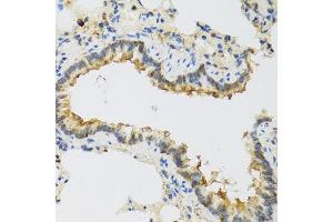 Immunohistochemistry of paraffin-embedded rat lung using FAM20A antibody at dilution of 1:100 (40x lens). (FAM20A Antikörper)