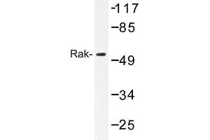 Image no. 1 for anti-Fyn-Related Kinase (FRK) antibody (ABIN272190) (FRK Antikörper)
