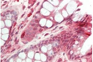 Human Colon: Formalin-Fixed, Paraffin-Embedded (FFPE)