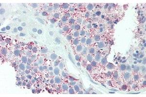 Detection of UCN2 in Human Testis Tissue using Polyclonal Antibody to Urocortin 2 (UCN2) (Urocortin 2 Antikörper  (AA 23-107))
