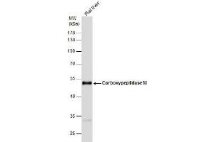 WB Image Carboxypeptidase M antibody [N1C2] detects Carboxypeptidase M protein by western blot analysis. (CPM Antikörper)
