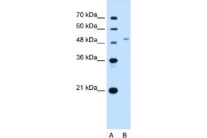 Western Blotting (WB) image for anti-Solute Carrier Family 29 (Nucleoside Transporters), Member 2 (SLC29A2) antibody (ABIN2462737)