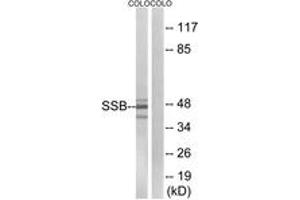 Western blot analysis of extracts from COLO cells, using SSB (Ab-366) Antibody. (SSB Antikörper  (AA 341-390))