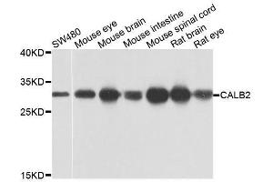 Western blot analysis of extracts of various cell lines, using CALB2 antibody (ABIN6003539) at 1/1000 dilution. (Calretinin Antikörper)