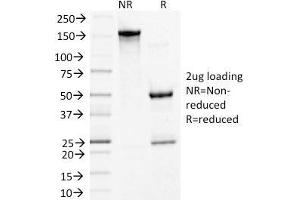 SDS-PAGE Analysis Purified Desmoglein-3 Monoclonal Antibody (5G11). (Desmoglein 3 Antikörper)