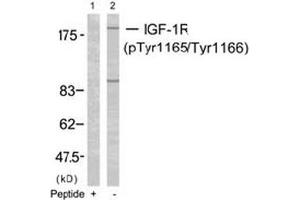 Image no. 2 for anti-Insulin-Like Growth Factor 1 Receptor (IGF1R) (pTyr1165), (pTyr1166) antibody (ABIN196774) (IGF1R Antikörper  (pTyr1165, pTyr1166))