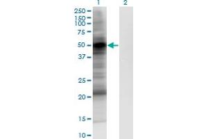 Western Blot analysis of PDPK1 expression in transfected 293T cell line by PDPK1 monoclonal antibody (M05), clone 2E2. (PDPK1 Antikörper  (AA 457-556))