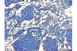 IHC analysis of PU.