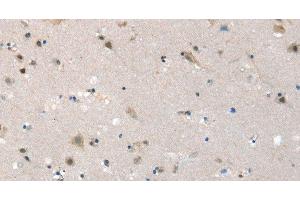 Immunohistochemistry of paraffin-embedded Human brain tissue using SLC6A7 Polyclonal Antibody at dilution 1:30