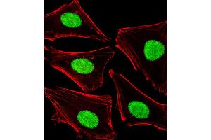 Fluorescent image of Hela cells stained with POLDIP3 Antibody (N-term). (POLDIP3 Antikörper  (N-Term))