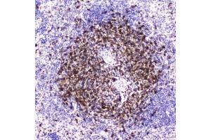 Immunohistochemistry (IHC) image for anti-CD5 (CD5) (AA 25-495) antibody (ABIN6654154)
