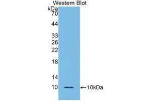 Western blot analysis of the recombinant protein. (IL-6 Receptor Antikörper  (AA 385-462))