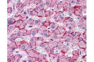 CDH1 antibody was used for immunohistochemistry at a concentration of 4-8 ug/ml. (E-cadherin Antikörper)