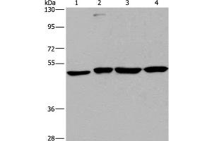 Western Blot analysis of A431, HepG2, Raji and K562 cell using CCR6 Polyclonal Antibody at dilution of 1:966 (CCR6 Antikörper)