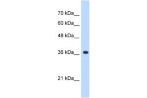 Western Blotting (WB) image for anti-alpha-1,4-N-Acetylglucosaminyltransferase (A4GNT) antibody (ABIN2463051) (A4GNT Antikörper)