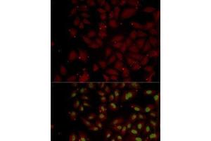 Immunofluorescence analysis of MCF7 cells using CCL25 Polyclonal Antibody (CCL25 Antikörper)