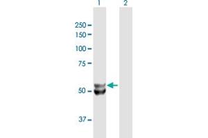 Western Blot analysis of UQCRC1 expression in transfected 293T cell line by UQCRC1 MaxPab polyclonal antibody. (UQCRC1 Antikörper  (AA 1-480))