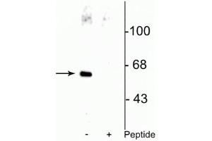 Western blot of HeLa cell lysate showing specific immunolabeling of the ~66 kDa Che-1 protein phosphorylated at Ser477 in the first lane (-). (AATF Antikörper  (pSer477))