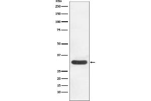 Western blot analysis of CDK4 expression in HeLa cell lysate. (Rekombinanter CDK4 Antikörper)