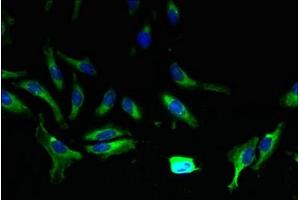 Immunofluorescent analysis of Hela cells using ABIN7144885 at dilution of 1:100 and Alexa Fluor 488-congugated AffiniPure Goat Anti-Rabbit IgG(H+L) (ABCA9 Antikörper  (AA 106-220))