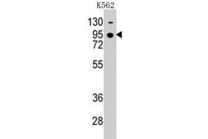 Western blot analysis of CDH7 polyclonal antibody  in K-562 cell line lysates (35 ug/lane). (Cadherin 7 Antikörper  (N-Term))