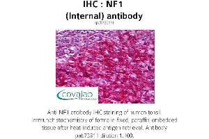 Image no. 1 for anti-Neurofibromin 1 (NF1) (Internal Region) antibody (ABIN1737327) (Neurofibromin 1 Antikörper  (Internal Region))