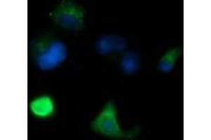 Image no. 2 for anti-Melan A (MLANA) antibody (ABIN1499427) (MLANA Antikörper)