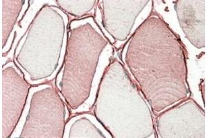 AP22425PU-N TRIM72 antibody staining of paraffin embedded Human Skeletal Muscle. (TRIM72 Antikörper  (Internal Region))