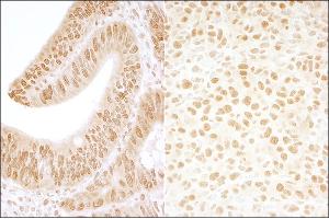 Immunohistochemistry (IHC) image for anti-Casein Kinase 2, beta (CSNK2B) (AA 100-150) antibody (ABIN7454541)