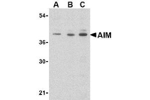 Image no. 1 for anti-CD5 Molecule-Like (CD5L) (N-Term) antibody (ABIN265123) (CD5L Antikörper  (N-Term))