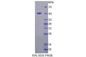 SDS-PAGE analysis of Rat BNIP3 Protein. (BNIP3 Protein)