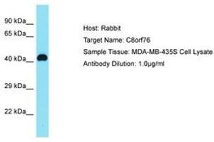 Image no. 1 for anti-Chromosome 8 Open Reading Frame 76 (C8orf76) (AA 61-110) antibody (ABIN6750711)