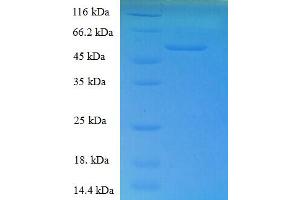 SDS-PAGE (SDS) image for Retinol Dehydrogenase 11 (All-Trans/9-Cis/11-Cis) (RDH11) (AA 22-318), (Cytoplasmic Domain), (Cytosolic) protein (His-SUMO Tag) (ABIN5710231) (RDH11 Protein (AA 22-318, Cytoplasmic Domain, Cytosolic) (His-SUMO Tag))