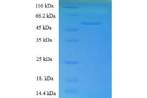 SDS-PAGE (SDS) image for Retinol Dehydrogenase 11 (All-Trans/9-Cis/11-Cis) (RDH11) (AA 22-318), (Cytoplasmic Domain), (Cytosolic) protein (His-SUMO Tag) (ABIN4975464)
