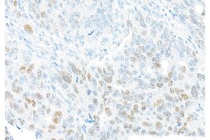 Immunohistochemistry (IHC) image for anti-Forkhead Box Q1 (FOXQ1) (AA 353-403) antibody (ABIN7455177) (Rekombinanter FOXQ1 Antikörper  (AA 353-403))