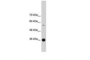 Image no. 3 for anti-Heterogeneous Nuclear Ribonucleoprotein A/B (HNRNPAB) (C-Term) antibody (ABIN203059)