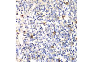 Immunohistochemistry of paraffin-embedded mouse spleen using PSMD7 antibody (ABIN1876544) at dilution of 1:100 (40x lens). (PSMD7 Antikörper)