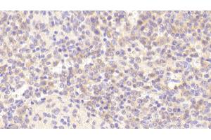 Immunohistochemistry (IHC) image for anti-Cholinergic Receptor, Nicotinic, alpha 4 (CHRNA4) (AA 49-242) antibody (ABIN7444463)