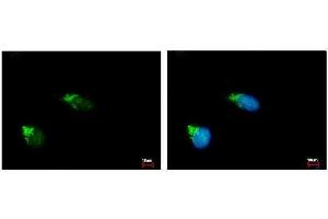 ICC/IF Image GALNT2 antibody [N1C1] detects GALNT2 protein at Golgi apparatus by immunofluorescent analysis. (GALNT2 Antikörper)