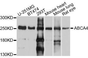 Western blot analysis of extracts of various cell lines, using ABCA4 antibody (ABIN5997165) at 1/1000 dilution. (ABCA4 Antikörper)